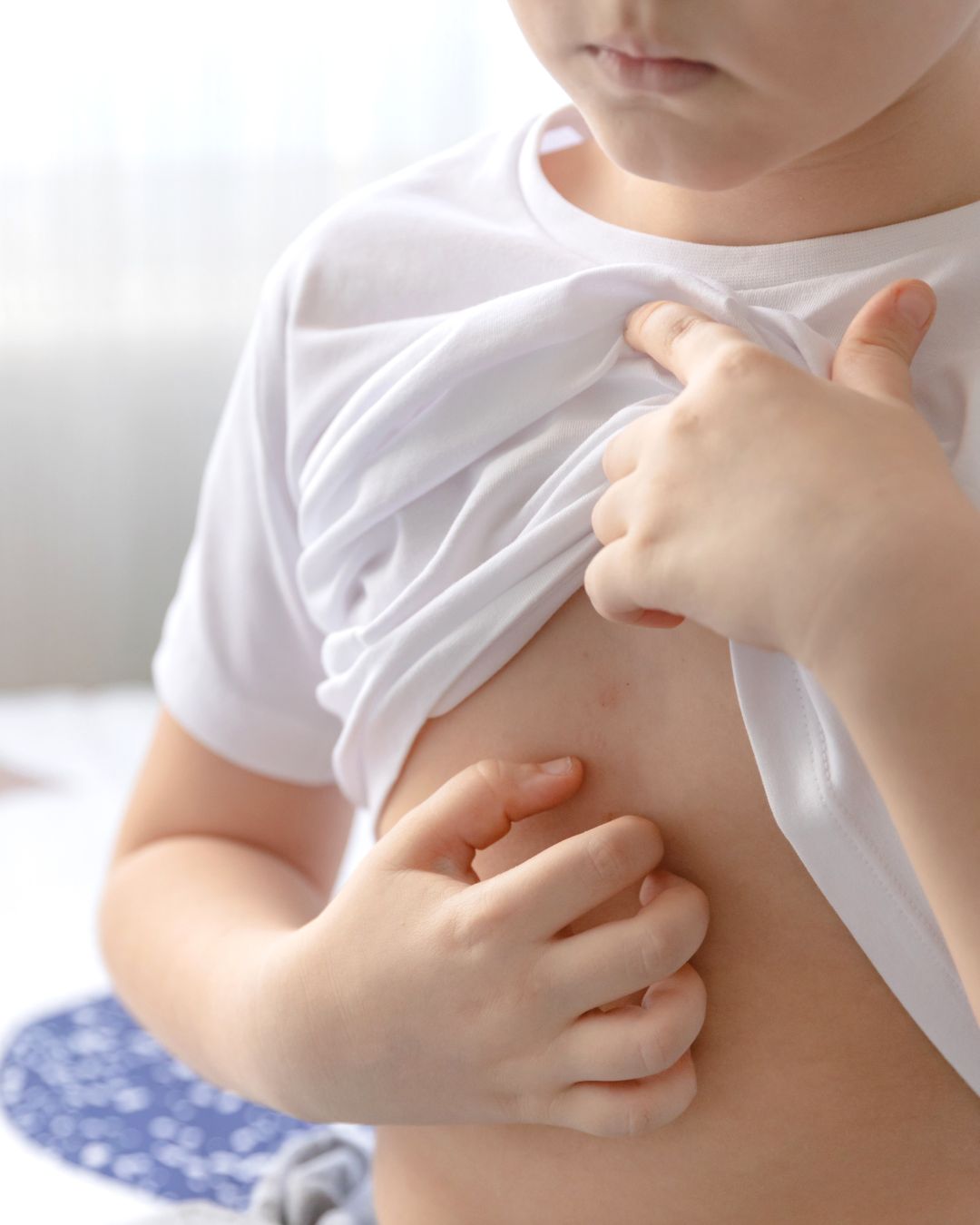 Niño rascándose por dermatitis atópica